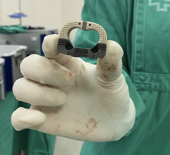 ALIF prótese coluna lombar