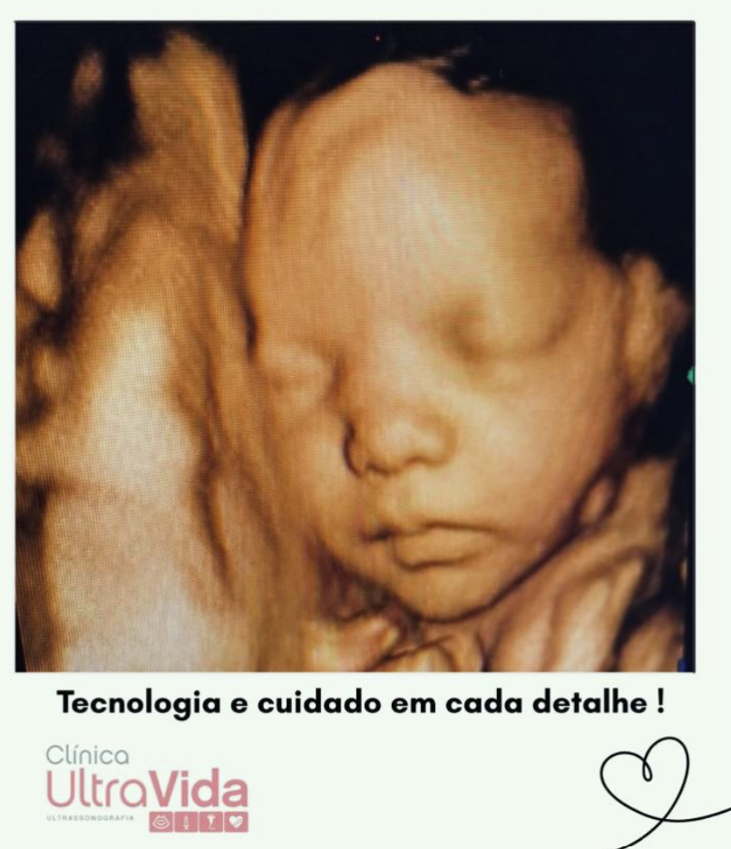 Ultrassom na Clínica UltraVida